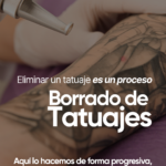Borrado de Tatuaje