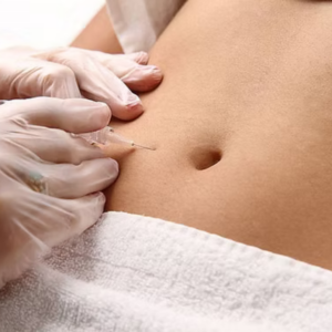 Carboxiterapia Reafirmante