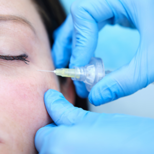 Carboxiterapia Facial