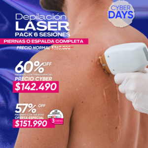 Depilación Láser Piernas o Espalda Completa Pack 6 ses.