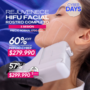 Hifu Facial Rostro Complesto 1 ses.