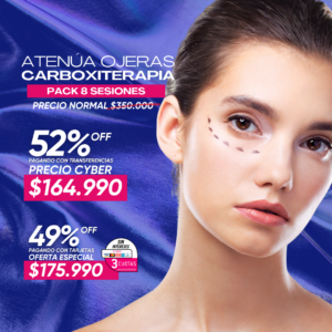 Atenúa Ojeras con Carboxiterapia 8 ses.
