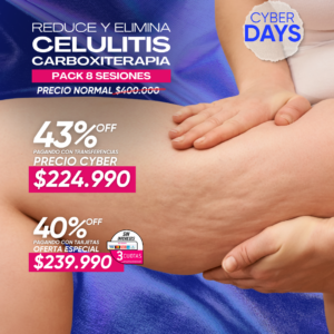 Carboxiterapia para Celulitis