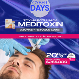 Meditoxin 3 Zonas + Retoque (100U)