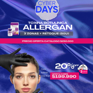 Botox 3 Zonas + Retoque (50U)