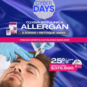 Botox 3 Zonas + Retoque (100U)