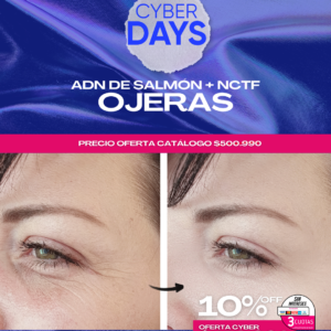 ADN Salmón + NCFT Ojeras