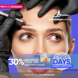 BABY BOTOX 1 ZONA - 30U