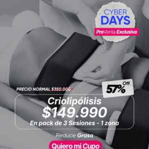 Criolipólisis