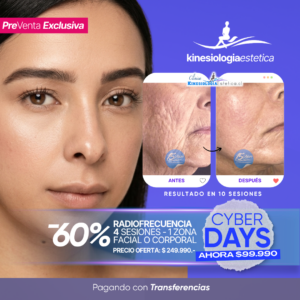 Radiofrecuencia  facial o corporal