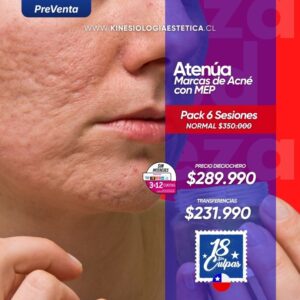 Atenúa Marcas de Acné con MEP