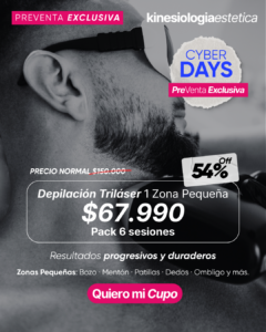 Depilación Triláser 1 Zona Pequeña