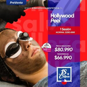 Hollywood Peel 1 sesión