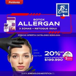 Botox ALLERGAN 3 ZONAS + RETOQUE (50U)