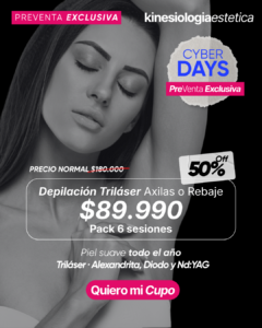 Depilación Triláser Axilas o Rebaje