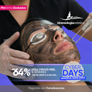 HOLLYWOOD PEEL 2 Sesiones