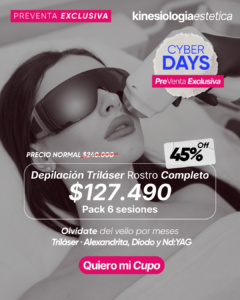 Depilación Triláser Rostro Completo