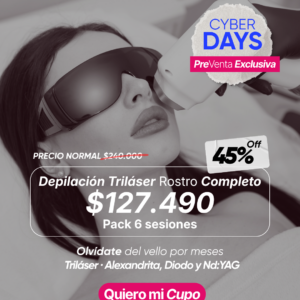 Depilación Triláser Rostro Completo