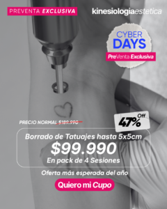 Borrado de Tatuajes hasta 5x5cm