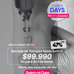 Borrado de Tatuajes hasta 5x5cm
