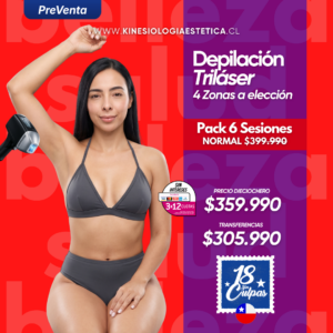 Depilación Triláser 4 Zonas a elección